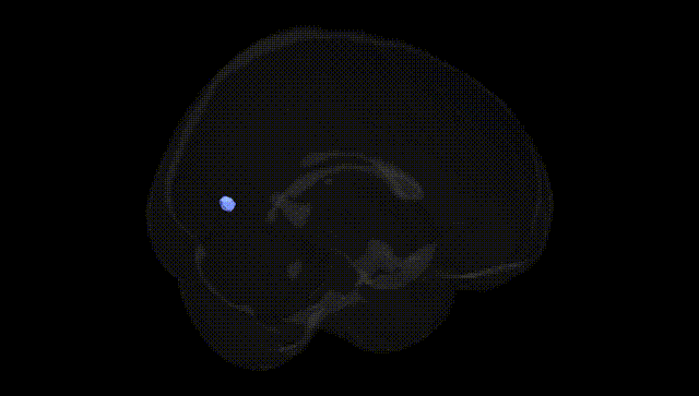 Full Brain Black