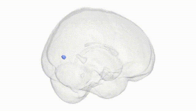 Full Brain White