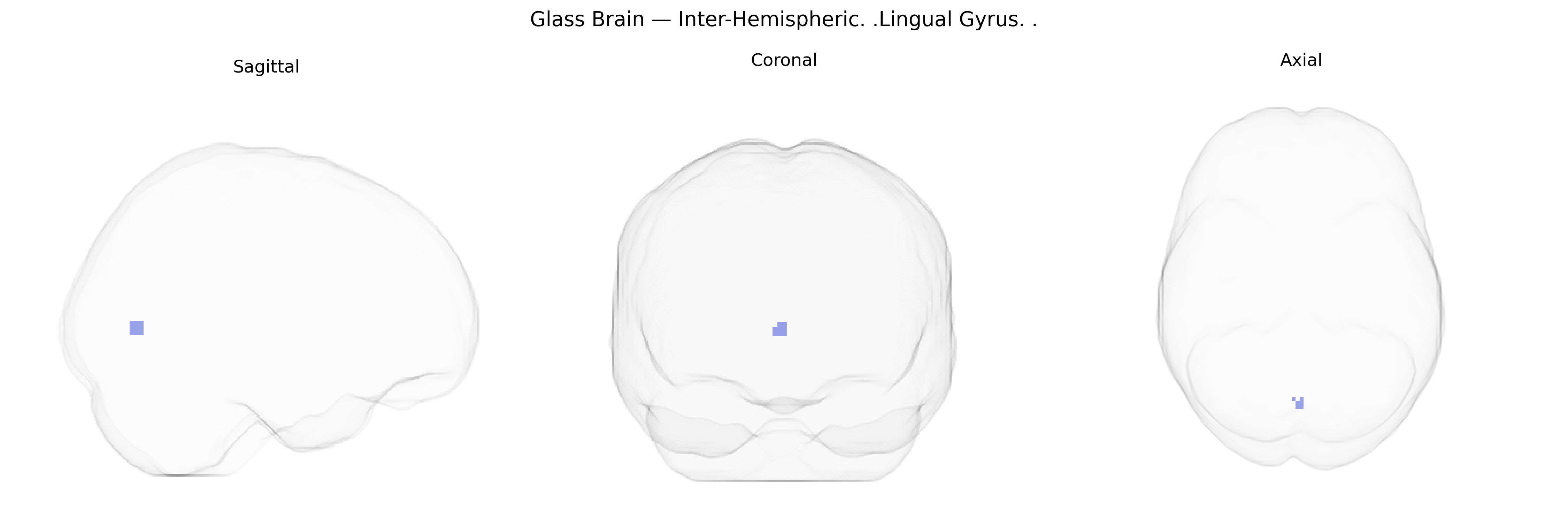 Triplanar Ghost Brain