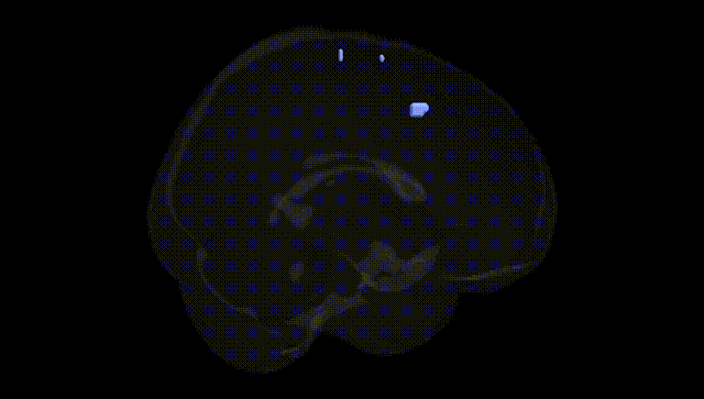 Full Brain Black