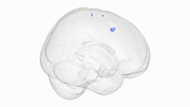 Full Brain White