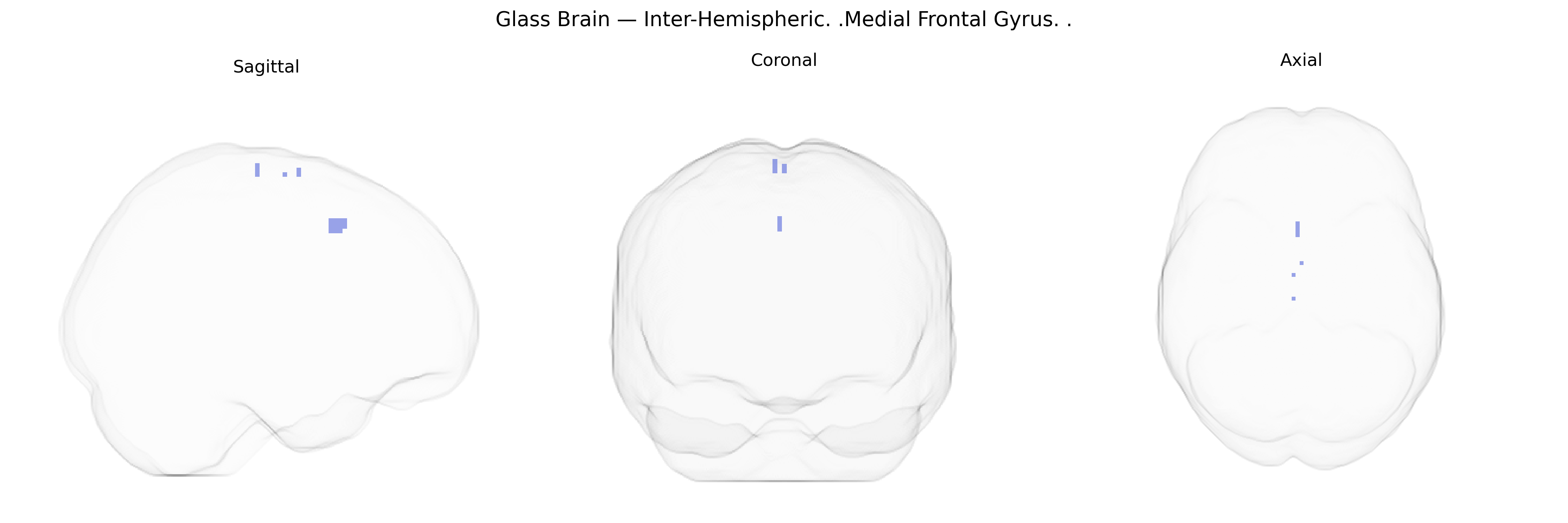 Triplanar Ghost Brain