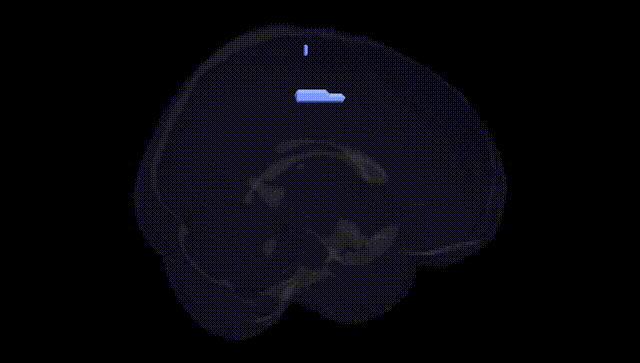 Full Brain Black