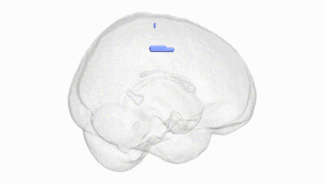 Full Brain White