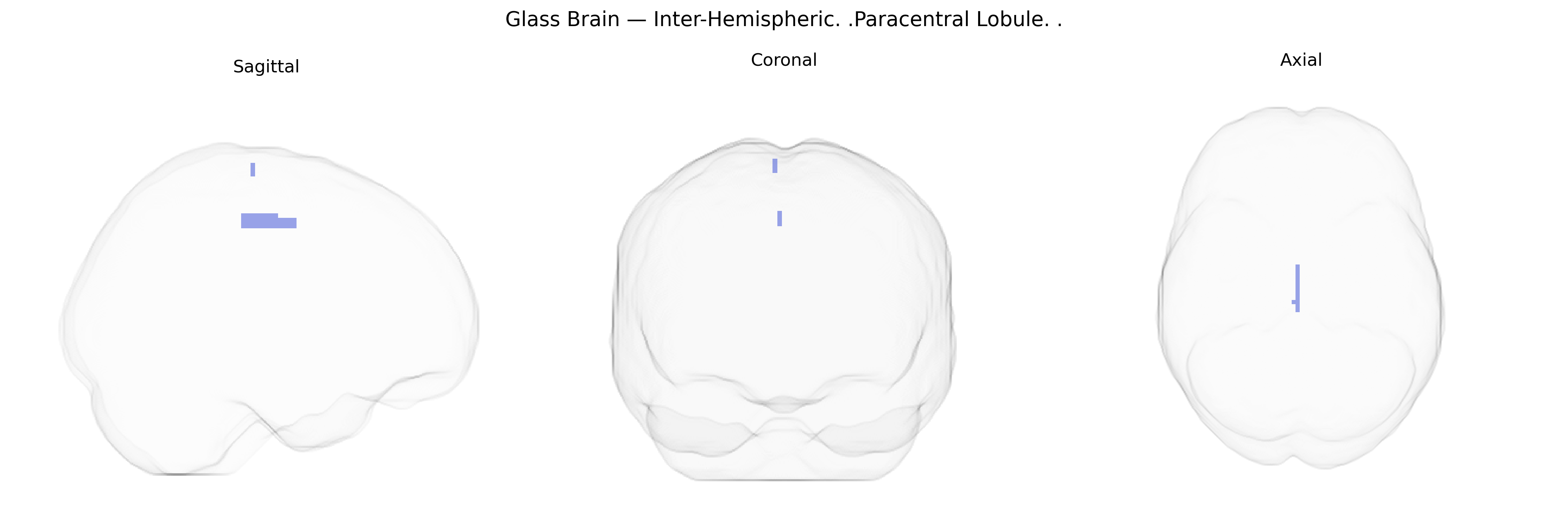 Triplanar Ghost Brain