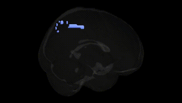 Full Brain Black