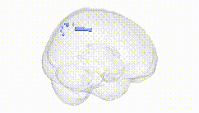 Full Brain White