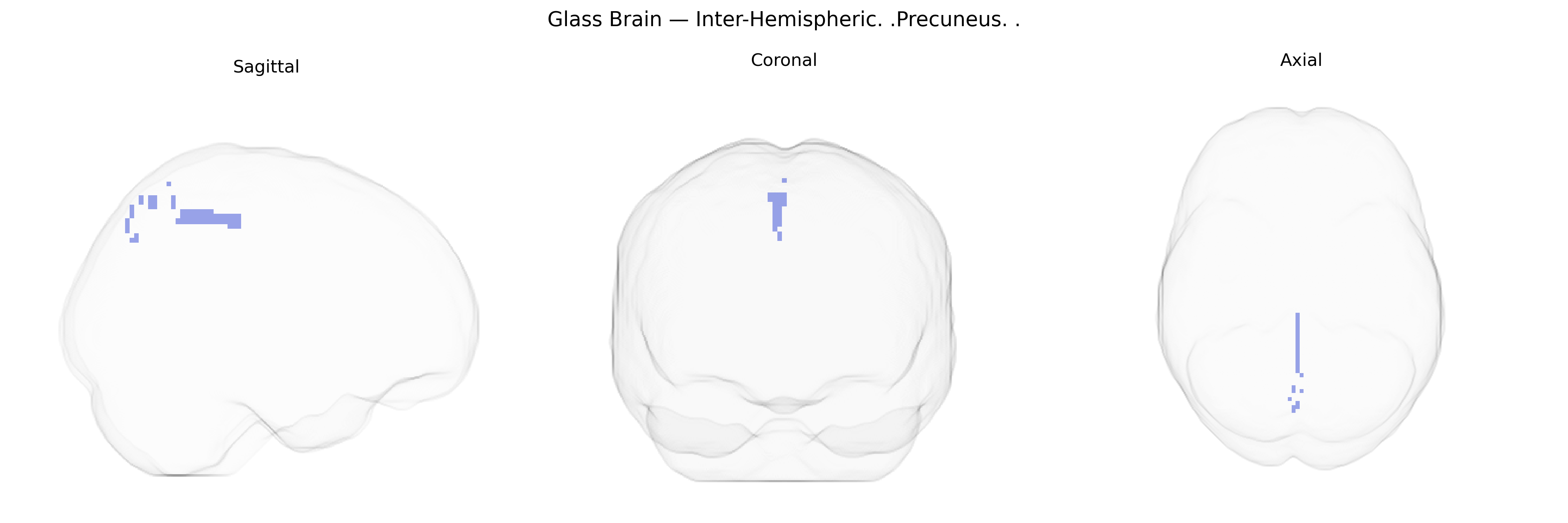 Triplanar Ghost Brain