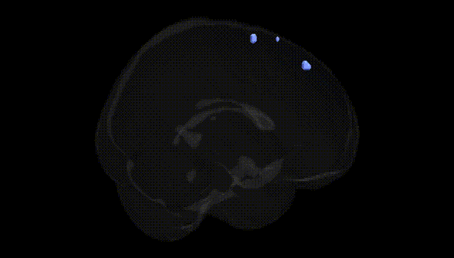 Full Brain Black