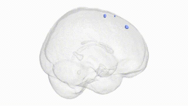 Full Brain White
