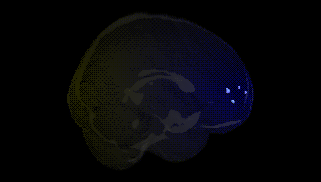 Full Brain Black