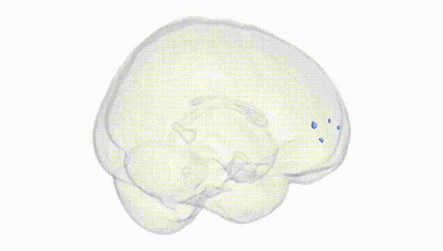 Full Brain White