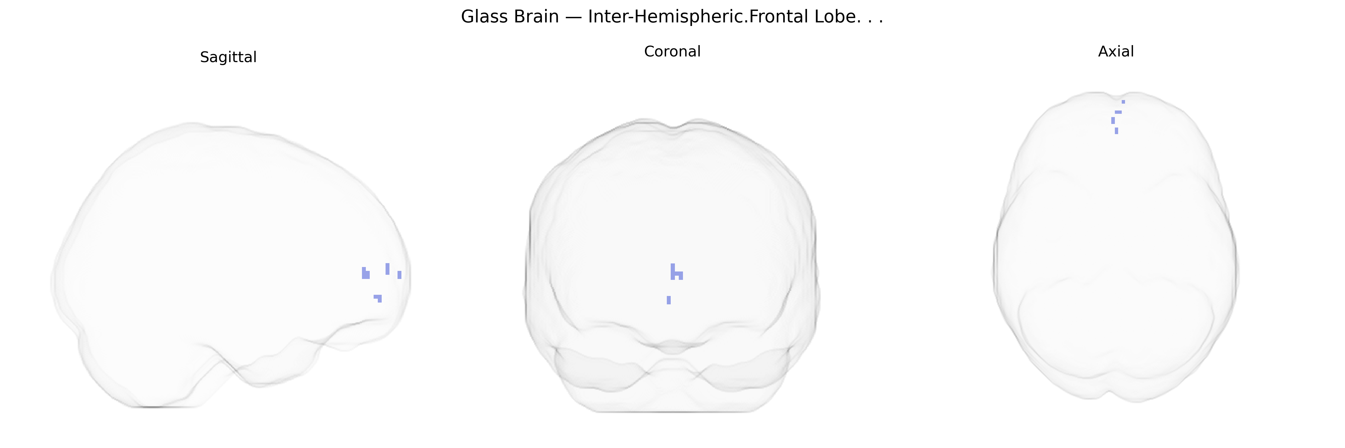 Triplanar Ghost Brain