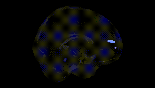 Full Brain Black