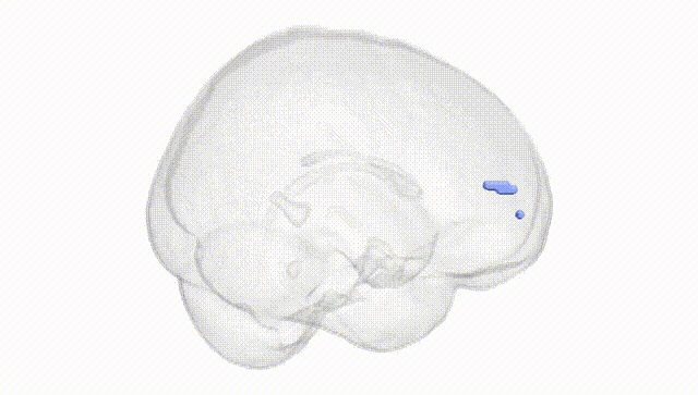 Full Brain White