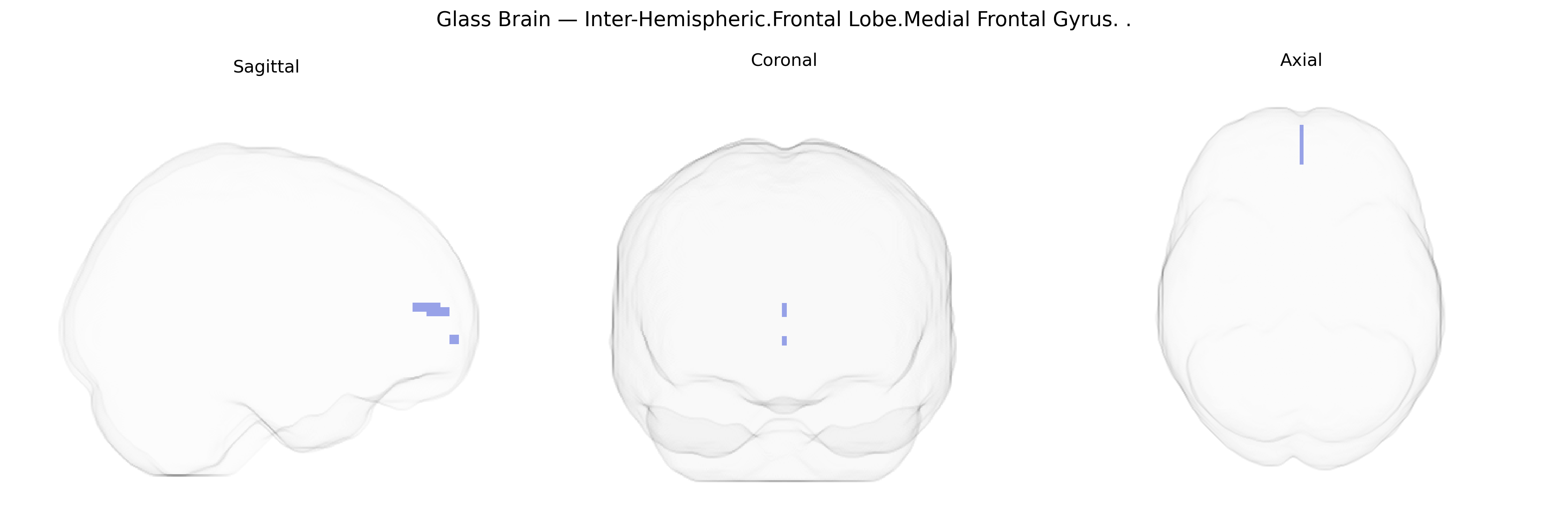Triplanar Ghost Brain