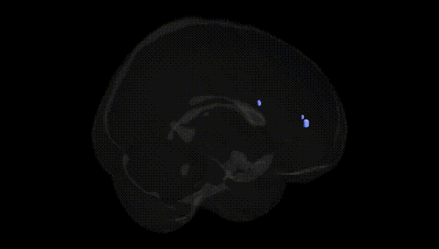 Full Brain Black