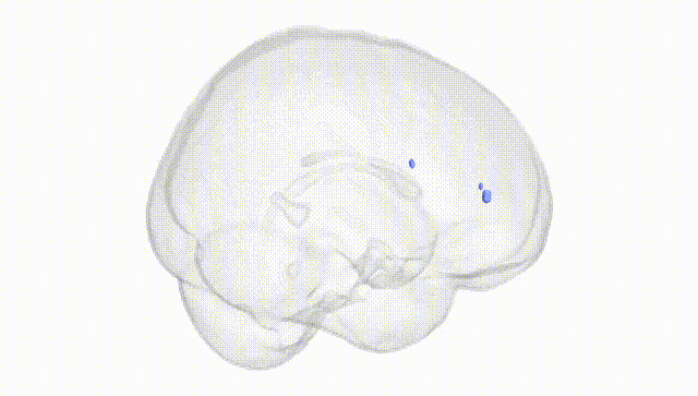 Full Brain White