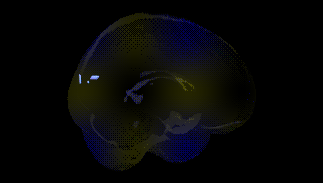 Full Brain Black
