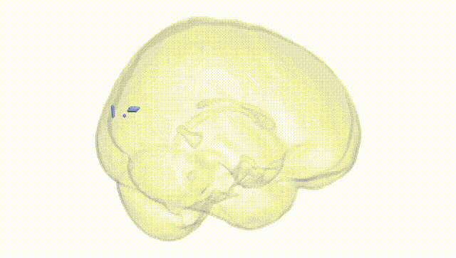 Full Brain White