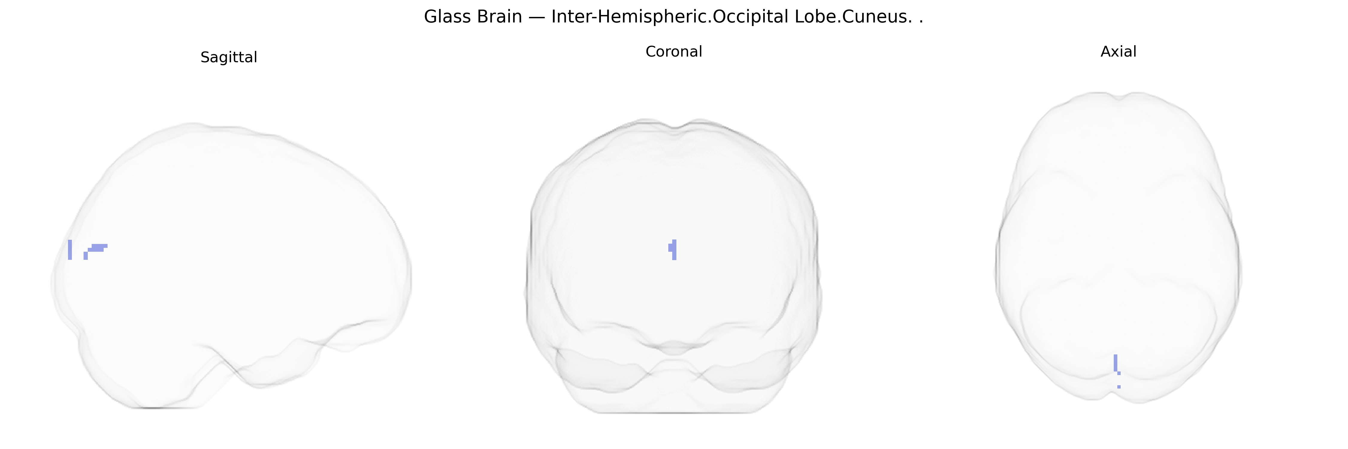 Triplanar Ghost Brain