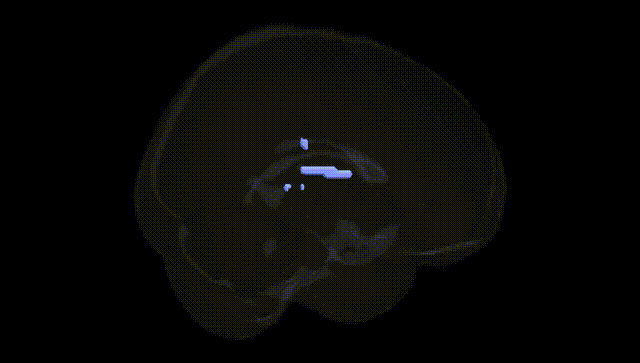 Full Brain Black