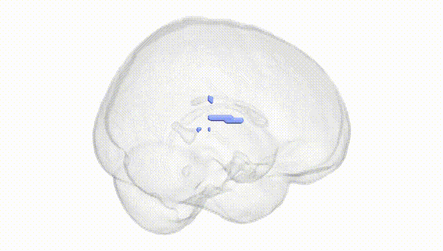 Full Brain White