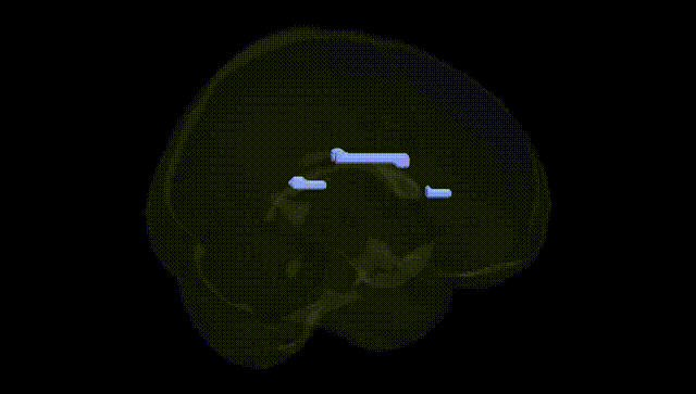 Full Brain Black