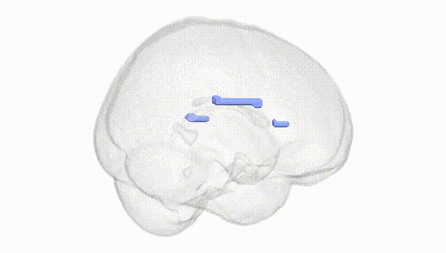 Full Brain White