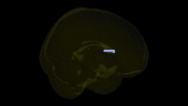 Full Brain Black