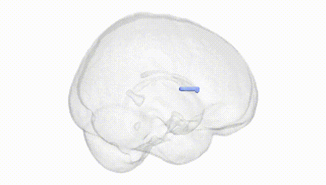 Full Brain White