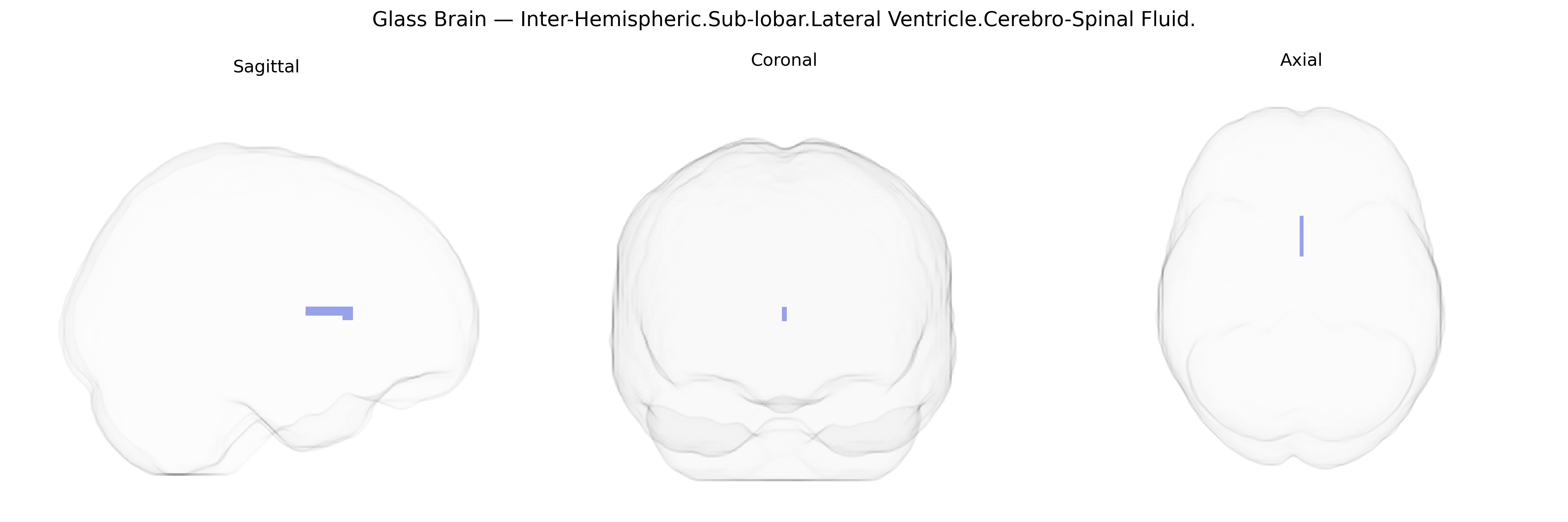 Triplanar Ghost Brain
