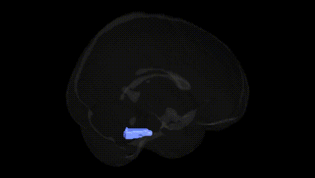 Full Brain Black