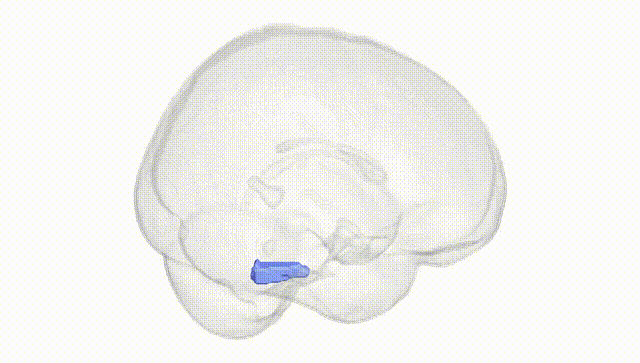 Full Brain White