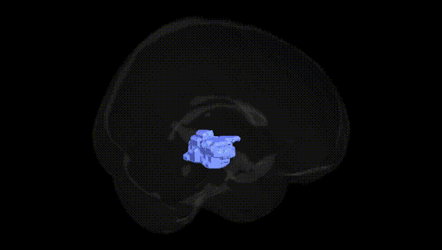 Full Brain Black
