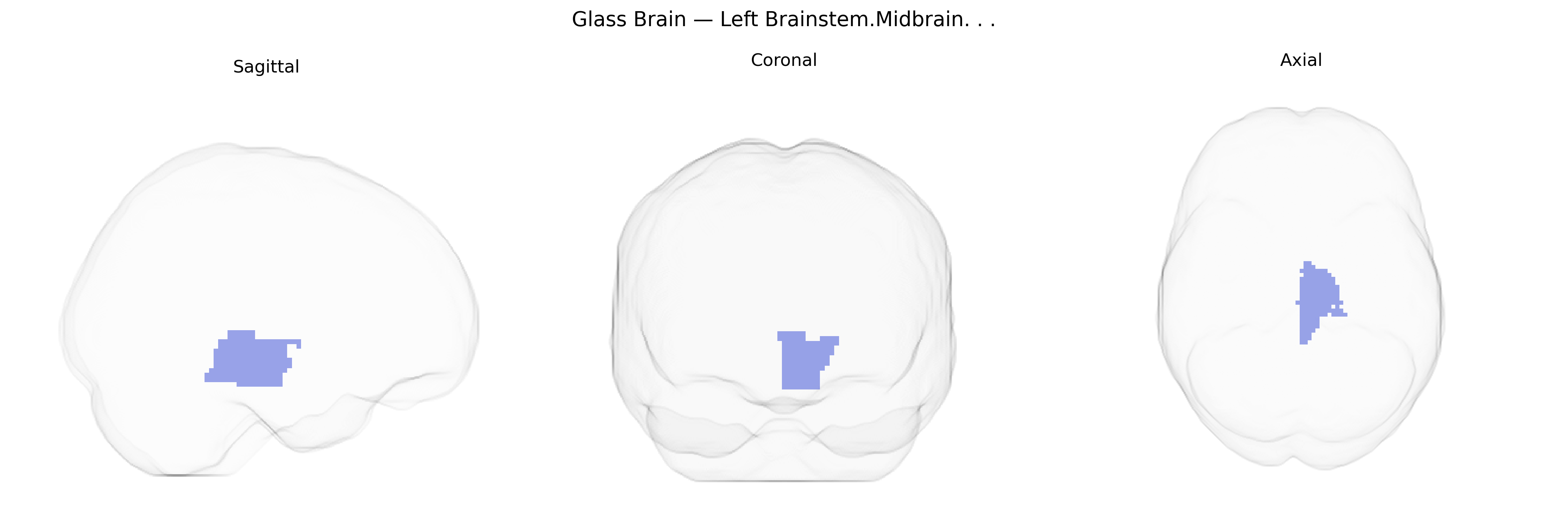 Triplanar Ghost Brain
