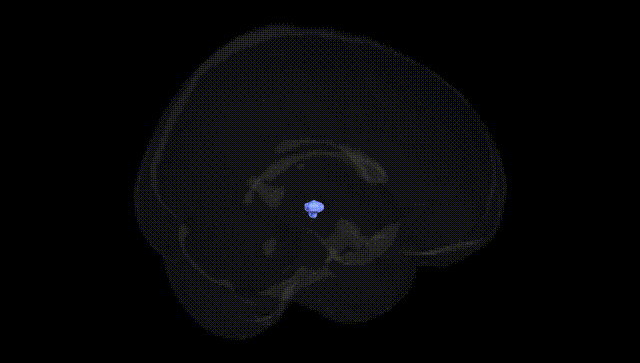 Full Brain Black