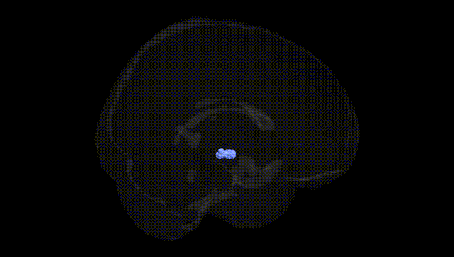 Full Brain Black