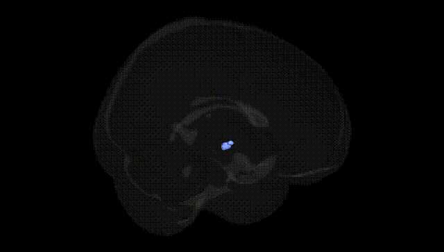Full Brain Black
