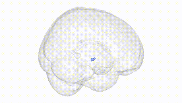 Full Brain White