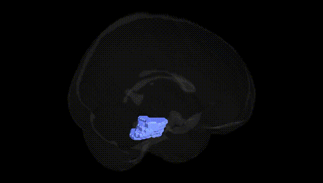 Full Brain Black