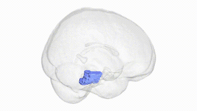 Full Brain White