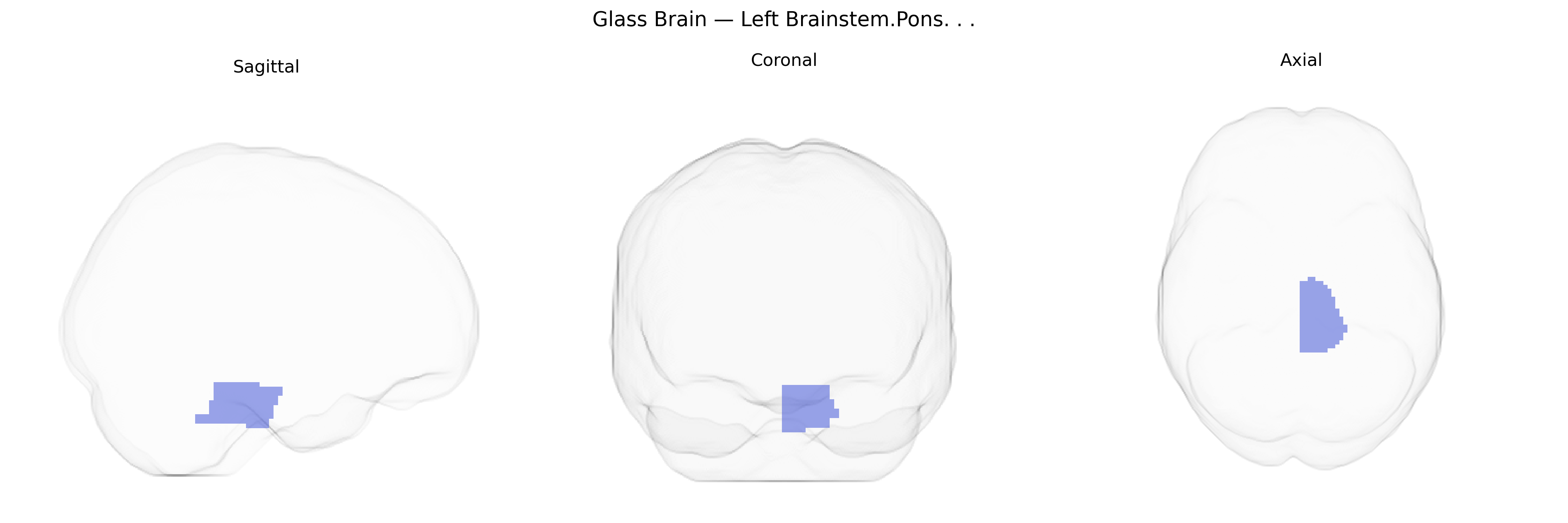 Triplanar Ghost Brain