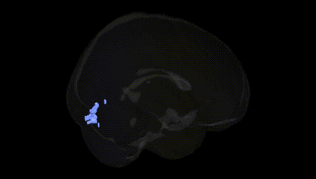 Full Brain Black