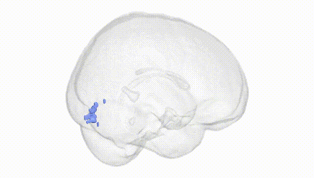 Full Brain White