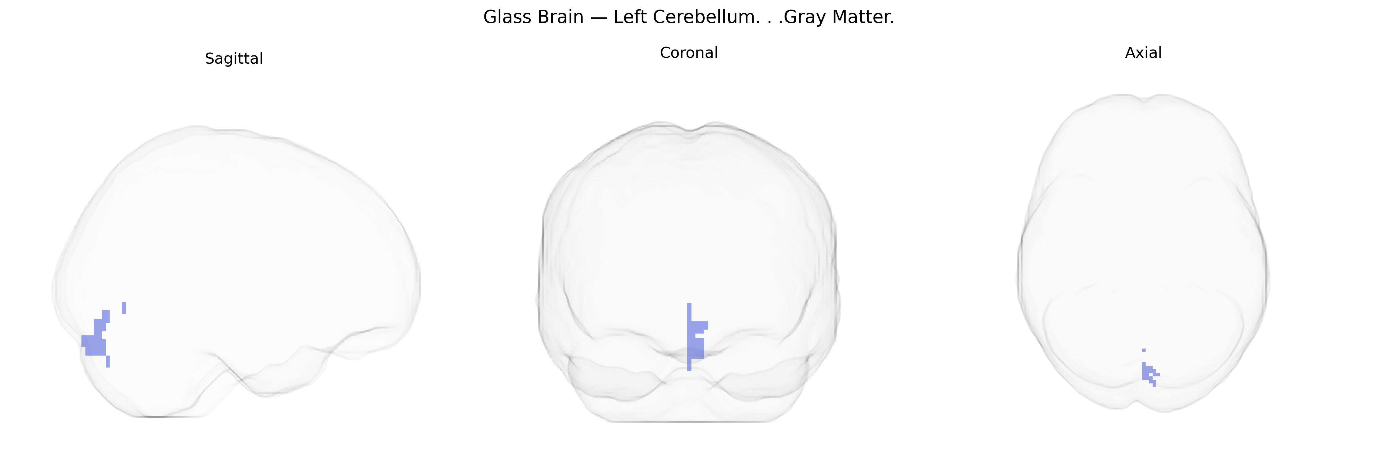 Triplanar Ghost Brain