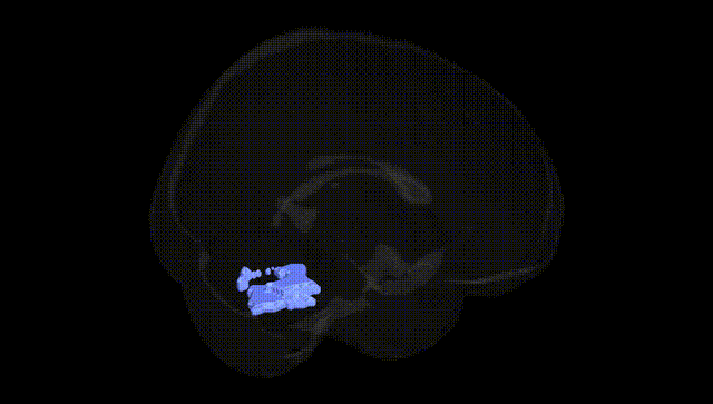 Full Brain Black