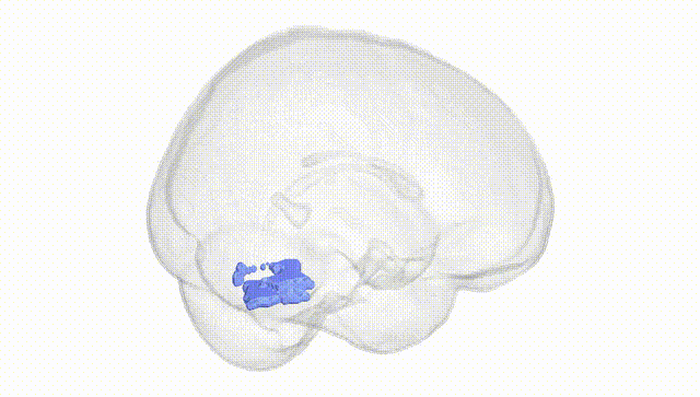 Full Brain White