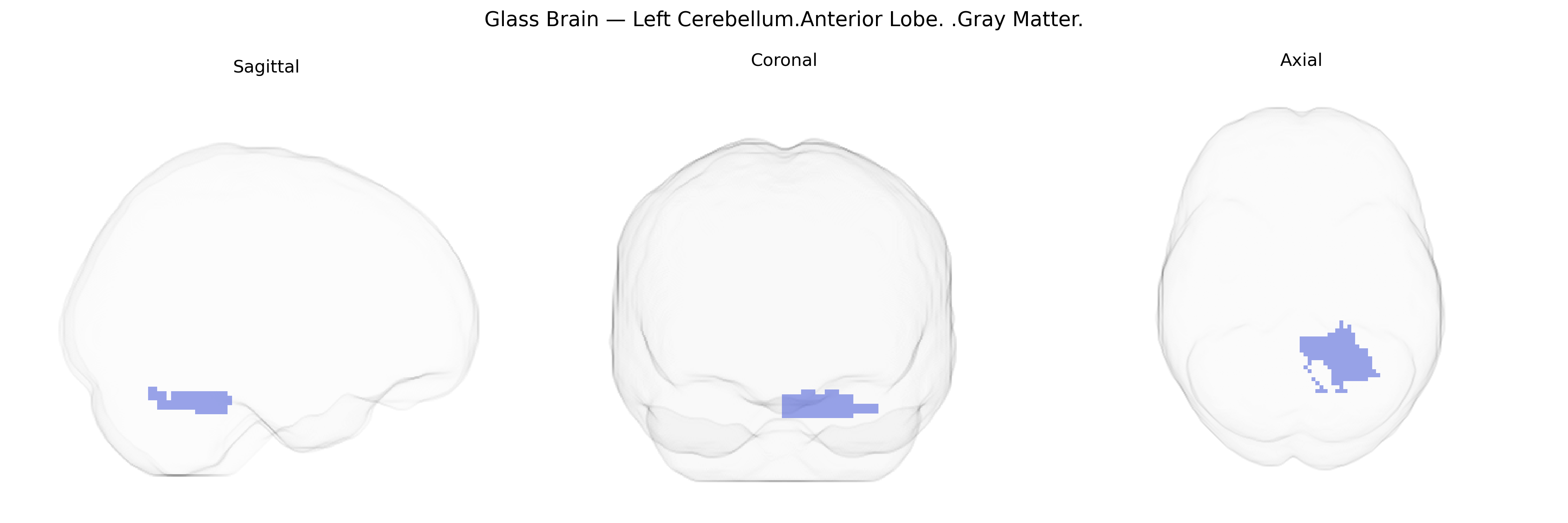 Triplanar Ghost Brain