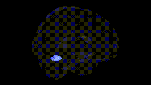 Full Brain Black